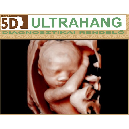 Human 5D Ultrahang Diagnosztikai Rendelő